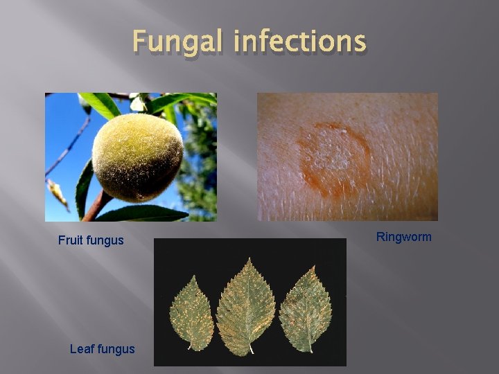 Fungal infections Fruit fungus Leaf fungus Ringworm Fungal infections Fruit fungus Leaf fungus Ringworm