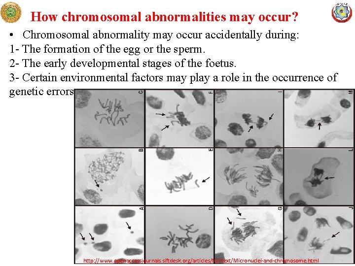 How chromosomal abnormalities may occur? • Chromosomal abnormality may occur accidentally during: 1 -