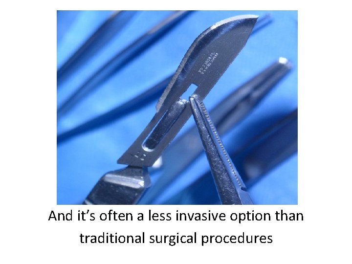 And it’s often a less invasive option than traditional surgical procedures 