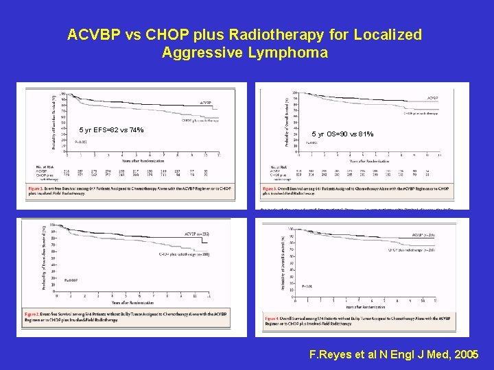 ACVBP vs CHOP plus Radiotherapy for Localized Aggressive Lymphoma 5 yr EFS=82 vs 74%