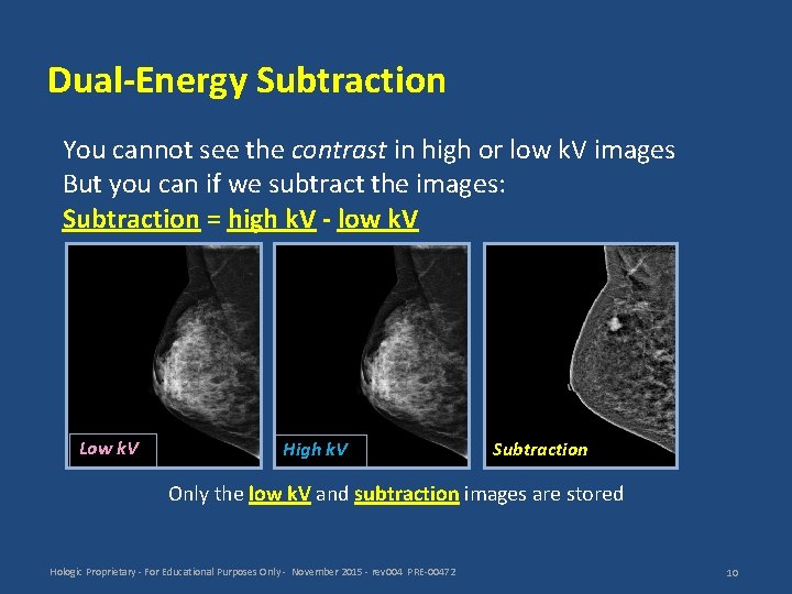 Dual-Energy Subtraction You cannot see the contrast in high or low k. V images