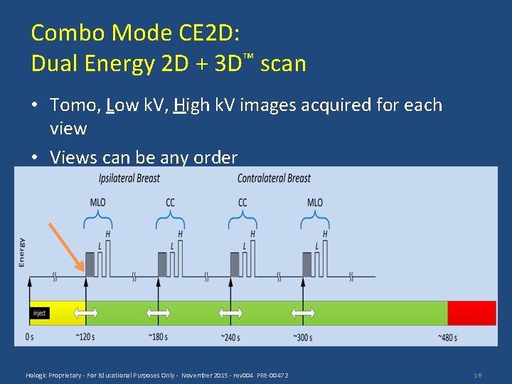 Combo Mode CE 2 D: Dual Energy 2 D + 3 D™ scan •