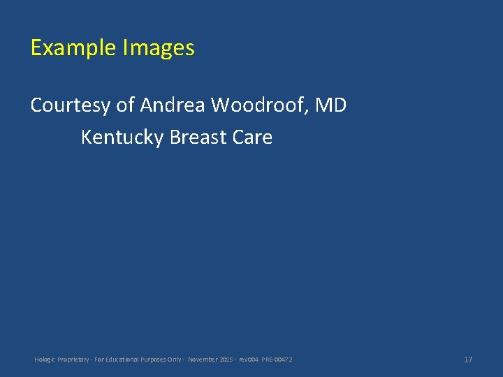 Example Images Courtesy of Andrea Woodroof, MD Kentucky Breast Care Hologic Proprietary - For