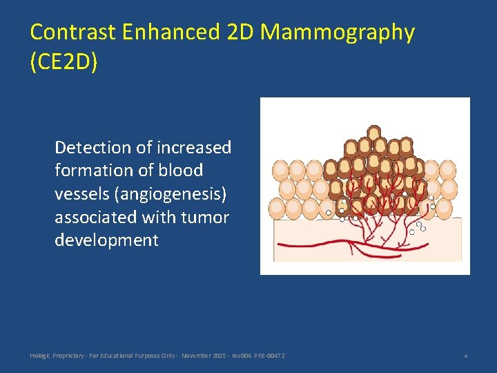 Contrast Enhanced 2 D Mammography (CE 2 D) Detection of increased formation of blood