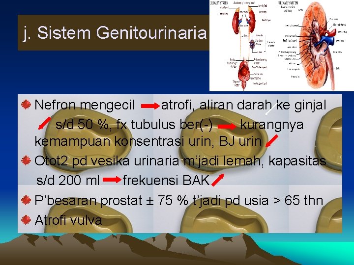 j. Sistem Genitourinaria Nefron mengecil atrofi, aliran darah ke ginjal s/d 50 %, fx