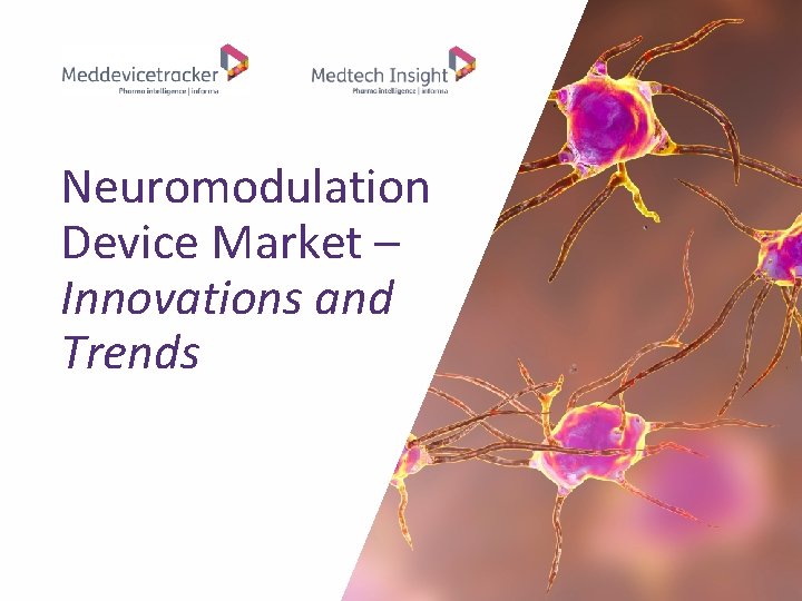 Neuromodulation Device Market – Innovations and Trends 