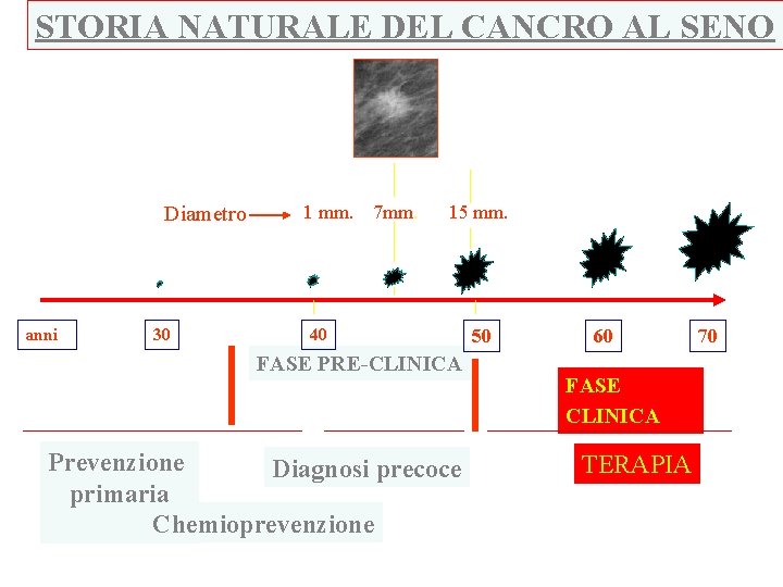 STORIA NATURALE DEL CANCRO AL SENO Diametro anni 30 1 mm. 7 mm. 15