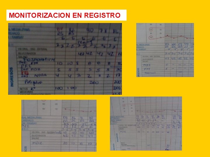 MONITORIZACION EN REGISTRO 