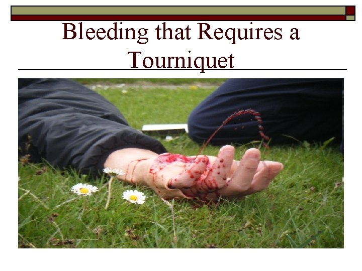Bleeding that Requires a Tourniquet 