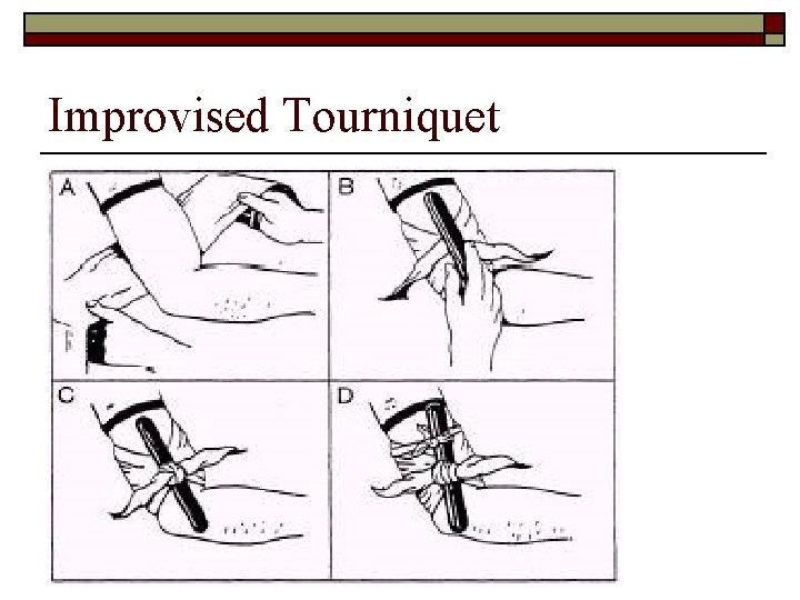 Improvised Tourniquet 