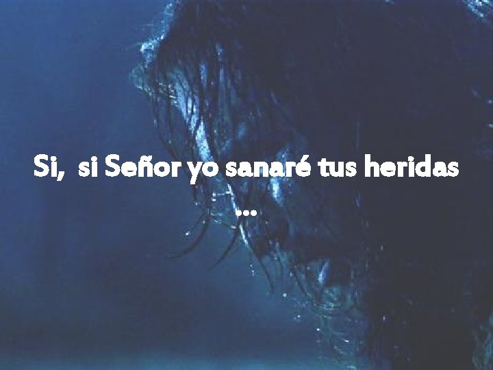 Si, si Señor yo sanaré tus heridas … 