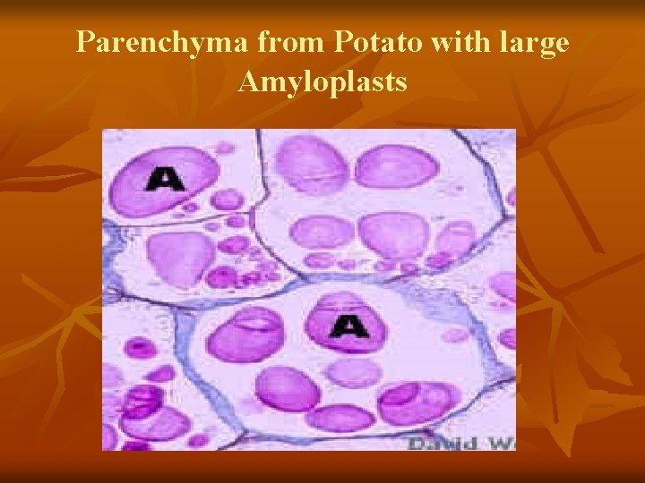 Parenchyma from Potato with large Amyloplasts 
