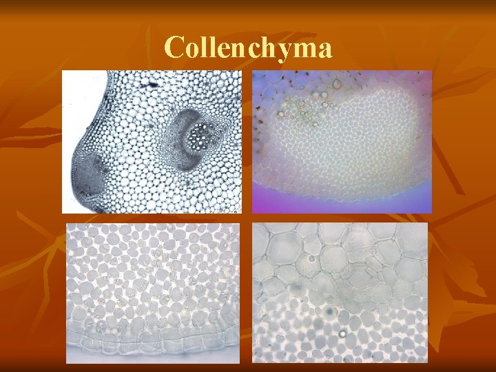 Collenchyma 