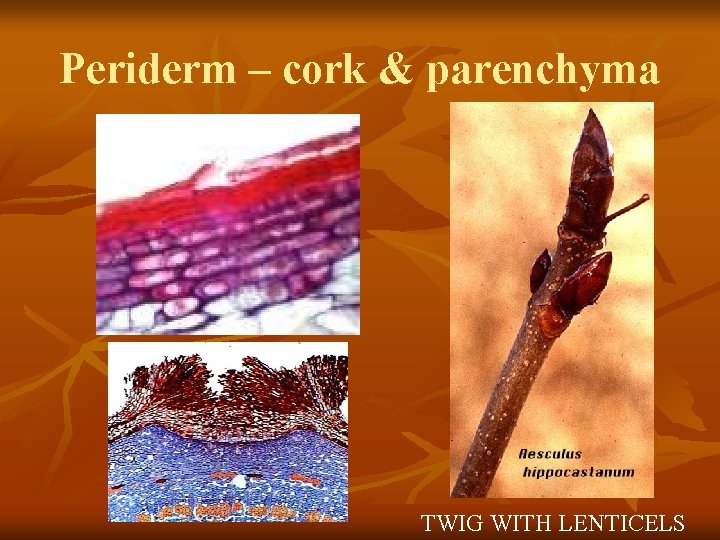 Periderm – cork & parenchyma TWIG WITH LENTICELS 