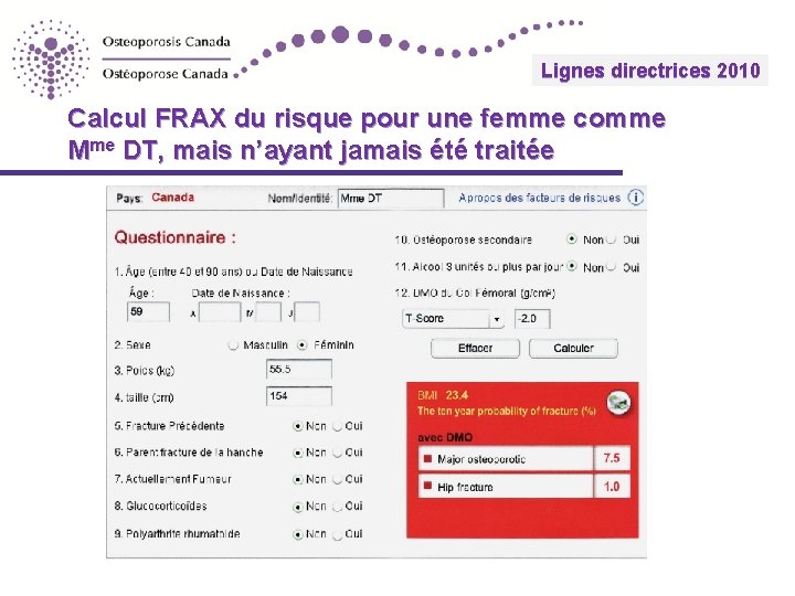 Lignes 2010 directrices Guidelines 2010 Calcul FRAX du risque pour une femme comme Mme