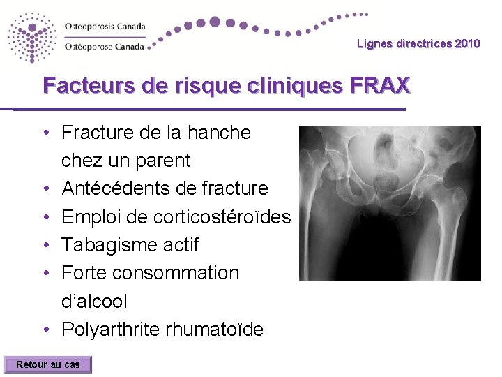 Lignes directrices 2010 Guidelines Facteurs de risque cliniques FRAX • Fracture de la hanche