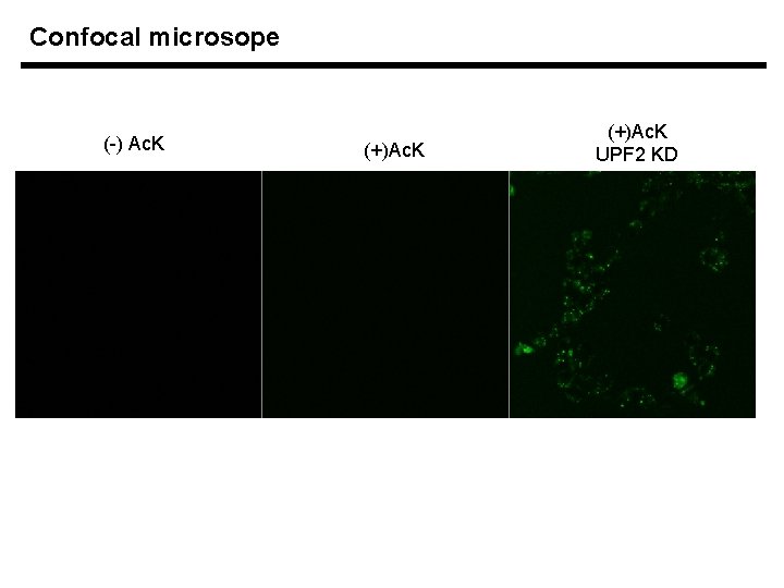 Confocal microsope (-) Ac. K (+)Ac. K UPF 2 KD 