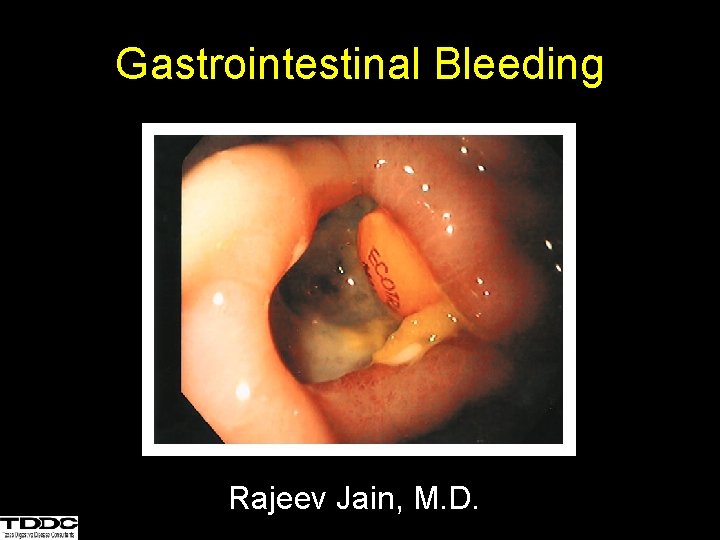 Gastrointestinal Bleeding Rajeev Jain, M. D. 