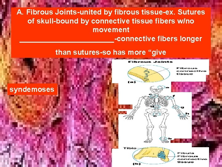 A. Fibrous Joints-united by fibrous tissue-ex. Sutures of skull-bound by connective tissue fibers w/no A. Fibrous Joints-united by fibrous tissue-ex. Sutures of skull-bound by connective tissue fibers w/no