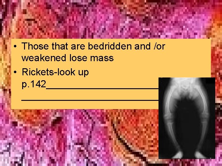• Those that are bedridden and /or weakened lose mass • Rickets-look up • Those that are bedridden and /or weakened lose mass • Rickets-look up