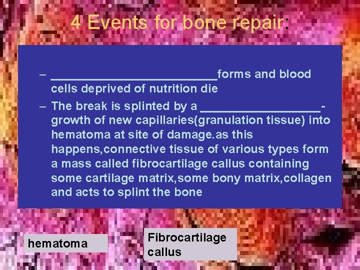 4 Events for bone repair: – _____________forms and blood cells deprived of nutrition die 4 Events for bone repair: – _____________forms and blood cells deprived of nutrition die