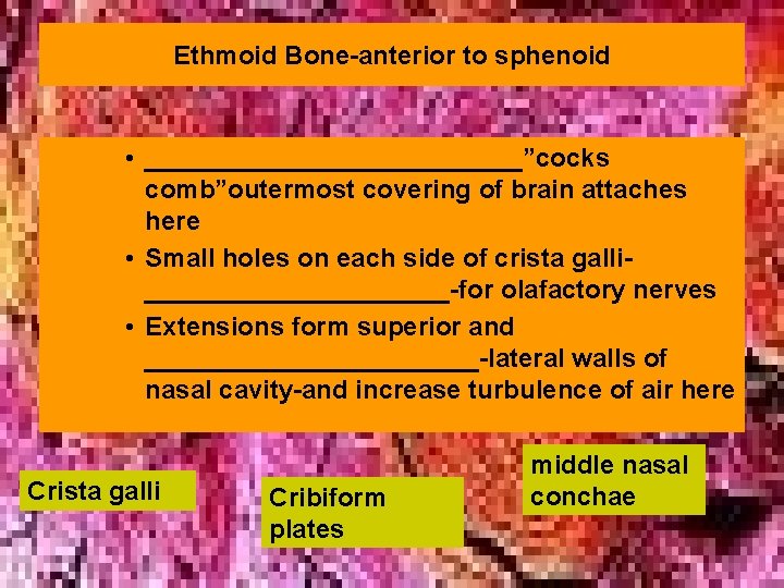 Ethmoid Bone-anterior to sphenoid • _____________”cocks comb”outermost covering of brain attaches here • Small Ethmoid Bone-anterior to sphenoid • _____________”cocks comb”outermost covering of brain attaches here • Small