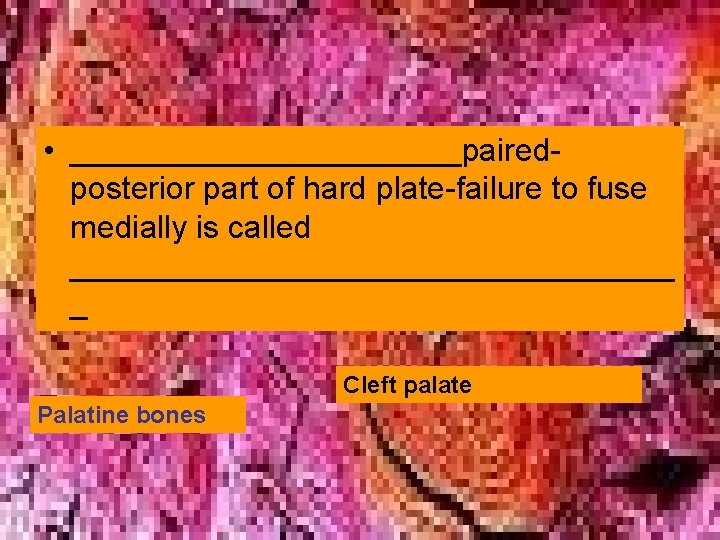 • ___________pairedposterior part of hard plate-failure to fuse medially is called _________________ _ • ___________pairedposterior part of hard plate-failure to fuse medially is called _________________ _