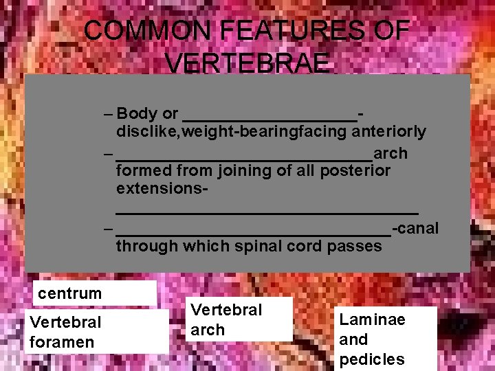 COMMON FEATURES OF VERTEBRAE – Body or __________disclike, weight-bearingfacing anteriorly – ______________arch formed from COMMON FEATURES OF VERTEBRAE – Body or __________disclike, weight-bearingfacing anteriorly – ______________arch formed from