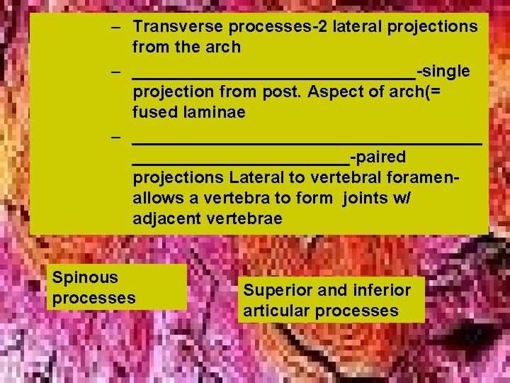 – Transverse processes-2 lateral projections from the arch – _______________-single projection from post. Aspect – Transverse processes-2 lateral projections from the arch – _______________-single projection from post. Aspect