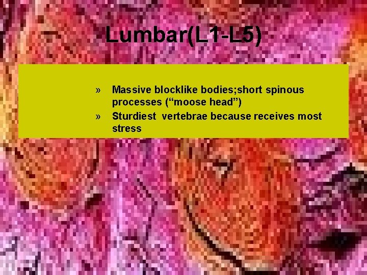 Lumbar(L 1 -L 5) » » Massive blocklike bodies; short spinous processes (“moose head”) Lumbar(L 1 -L 5) » » Massive blocklike bodies; short spinous processes (“moose head”)