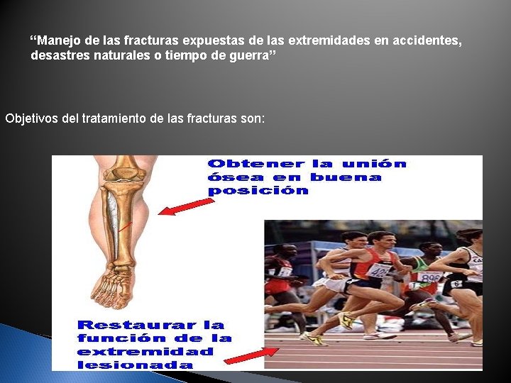 “Manejo de las fracturas expuestas de las extremidades en accidentes, desastres naturales o tiempo “Manejo de las fracturas expuestas de las extremidades en accidentes, desastres naturales o tiempo
