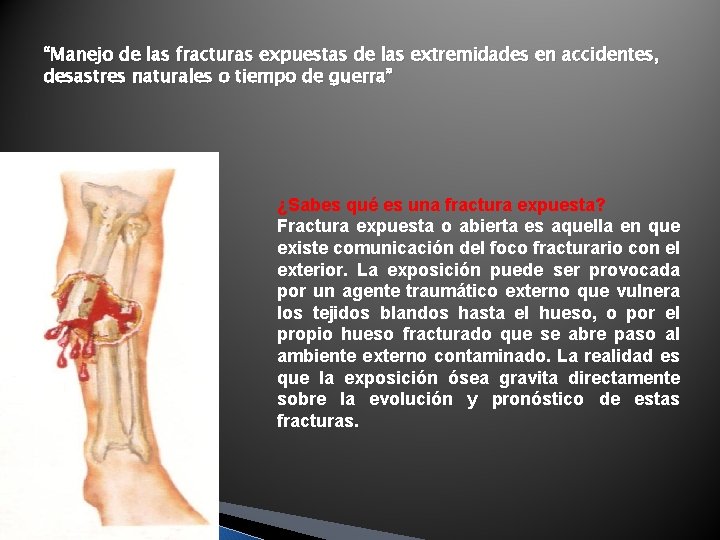 “Manejo de las fracturas expuestas de las extremidades en accidentes, desastres naturales o tiempo “Manejo de las fracturas expuestas de las extremidades en accidentes, desastres naturales o tiempo
