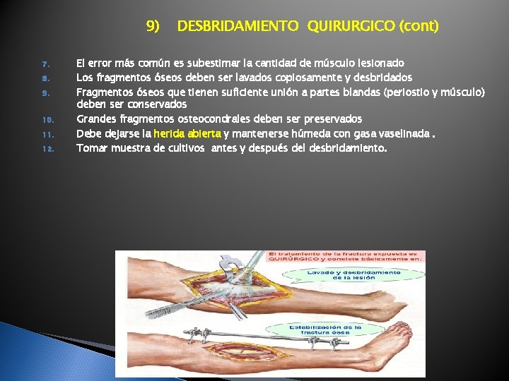 9) 7. 8. 9. 10. 11. 12. DESBRIDAMIENTO QUIRURGICO (cont) El error más común 9) 7. 8. 9. 10. 11. 12. DESBRIDAMIENTO QUIRURGICO (cont) El error más común