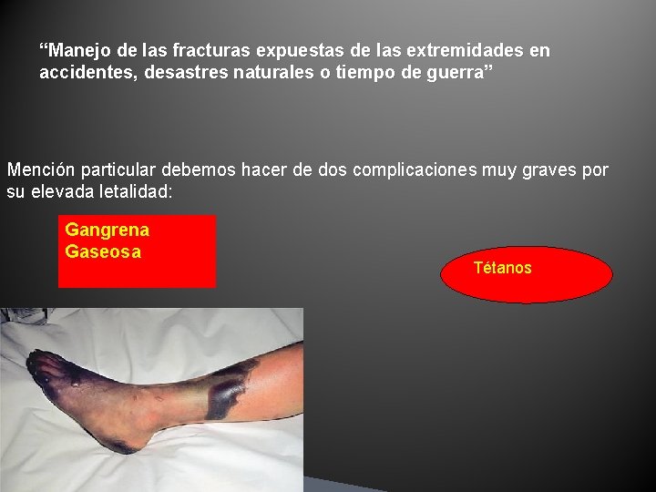 “Manejo de las fracturas expuestas de las extremidades en accidentes, desastres naturales o tiempo “Manejo de las fracturas expuestas de las extremidades en accidentes, desastres naturales o tiempo