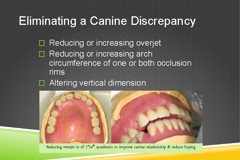 Eliminating a Canine Discrepancy � Reducing or increasing overjet � Reducing or increasing arch