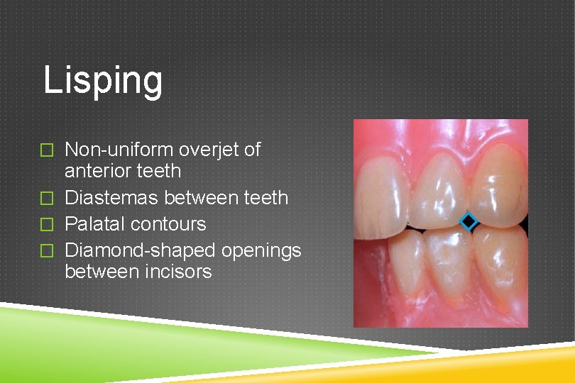 Lisping � Non-uniform overjet of anterior teeth � Diastemas between teeth � Palatal contours