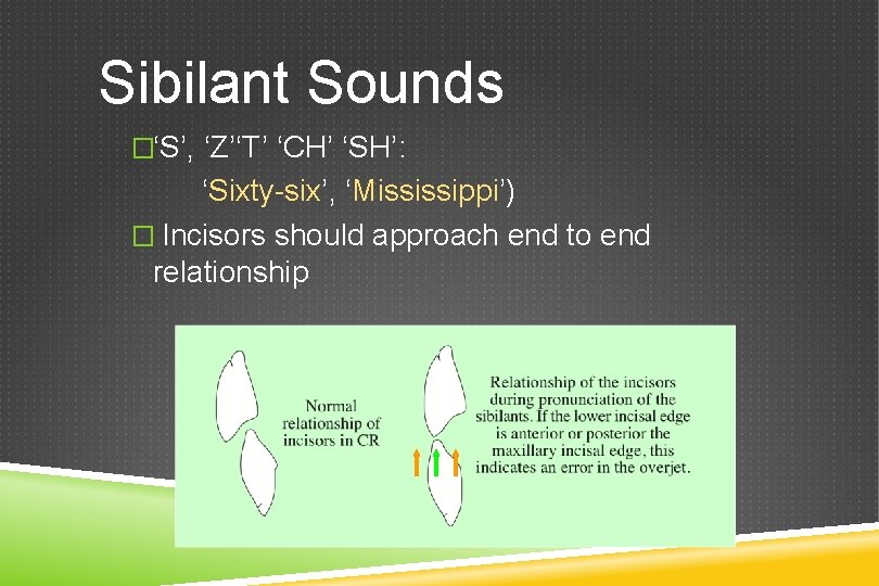 Sibilant Sounds �‘S’, ‘Z’‘T’ ‘CH’ ‘SH’: ‘Sixty-six’, ‘Mississippi’) � Incisors should approach end to