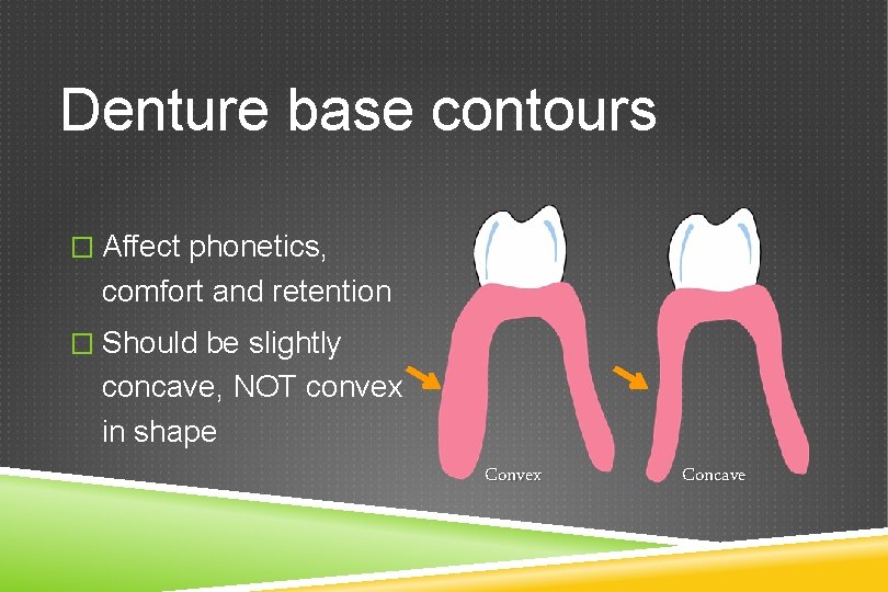 Denture base contours � Affect phonetics, comfort and retention � Should be slightly concave,