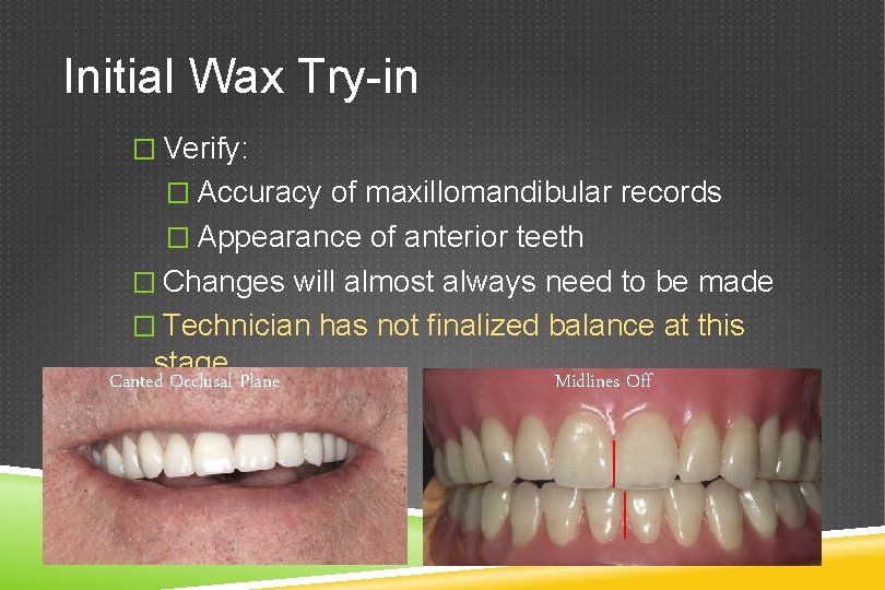 Initial Wax Try-in � Verify: � Accuracy of maxillomandibular records � Appearance of anterior