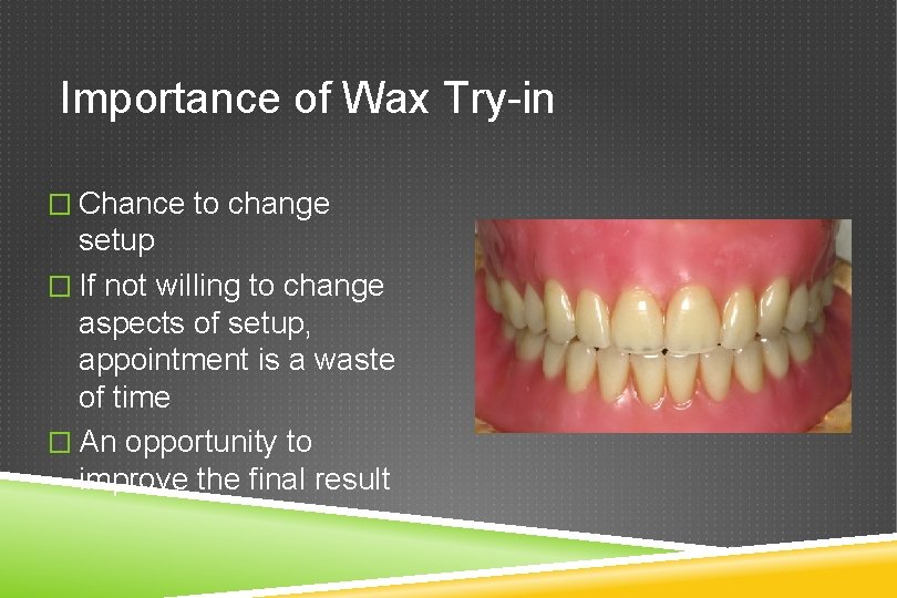 Importance of Wax Try-in � Chance to change setup � If not willing to