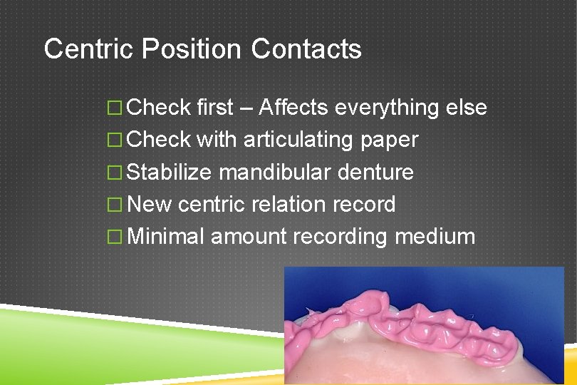 Centric Position Contacts � Check first – Affects everything else � Check with articulating