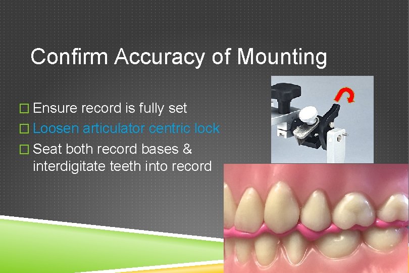 Confirm Accuracy of Mounting � Ensure record is fully set � Loosen articulator centric