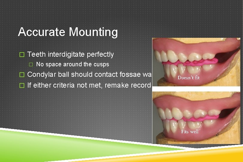 Accurate Mounting � Teeth interdigitate perfectly � No space around the cusps � Condylar