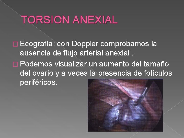 TORSION ANEXIAL � Ecografía: con Doppler comprobamos la ausencia de flujo arterial anexial. �