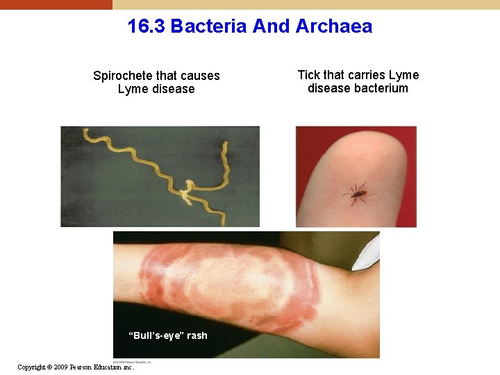 16. 3 Bacteria And Archaea Spirochete that causes Lyme disease “Bull’s-eye” rash Copyright © 16. 3 Bacteria And Archaea Spirochete that causes Lyme disease “Bull’s-eye” rash Copyright ©