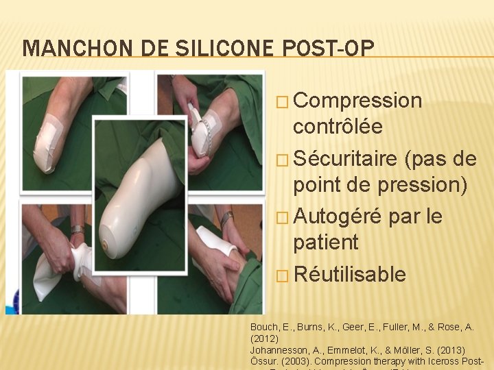 MANCHON DE SILICONE POST-OP � Compression contrôlée � Sécuritaire (pas de point de pression)