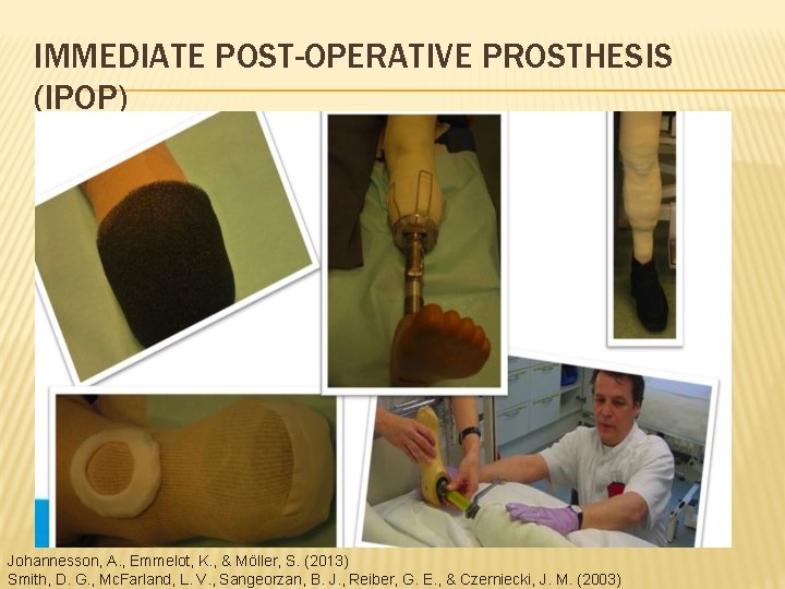 IMMEDIATE POST-OPERATIVE PROSTHESIS (IPOP) Johannesson, A. , Emmelot, K. , & Möller, S. (2013)