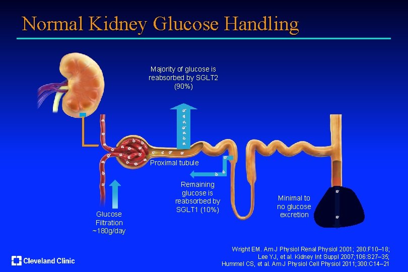 Normal Kidney Glucose Handling Majority of glucose is reabsorbed by SGLT 2 (90%) Proximal
