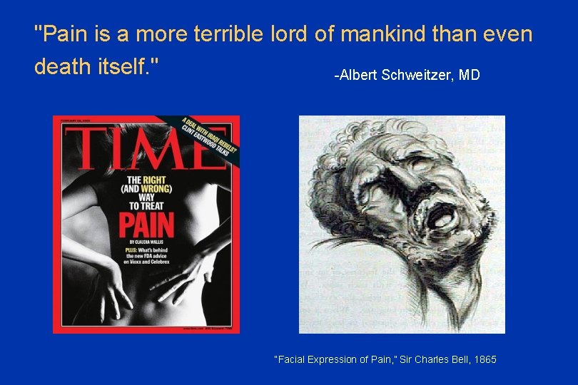 "Pain is a more terrible lord of mankind than even death itself. " -Albert