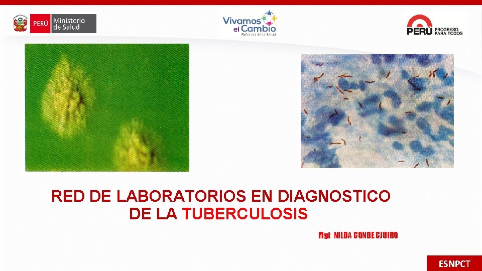 RED DE LABORATORIOS EN DIAGNOSTICO DE LA TUBERCULOSIS Mgt NILDA CONDE CJUIRO ESNPCT 